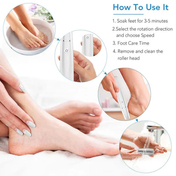 🔥Electric callus remover for feet
